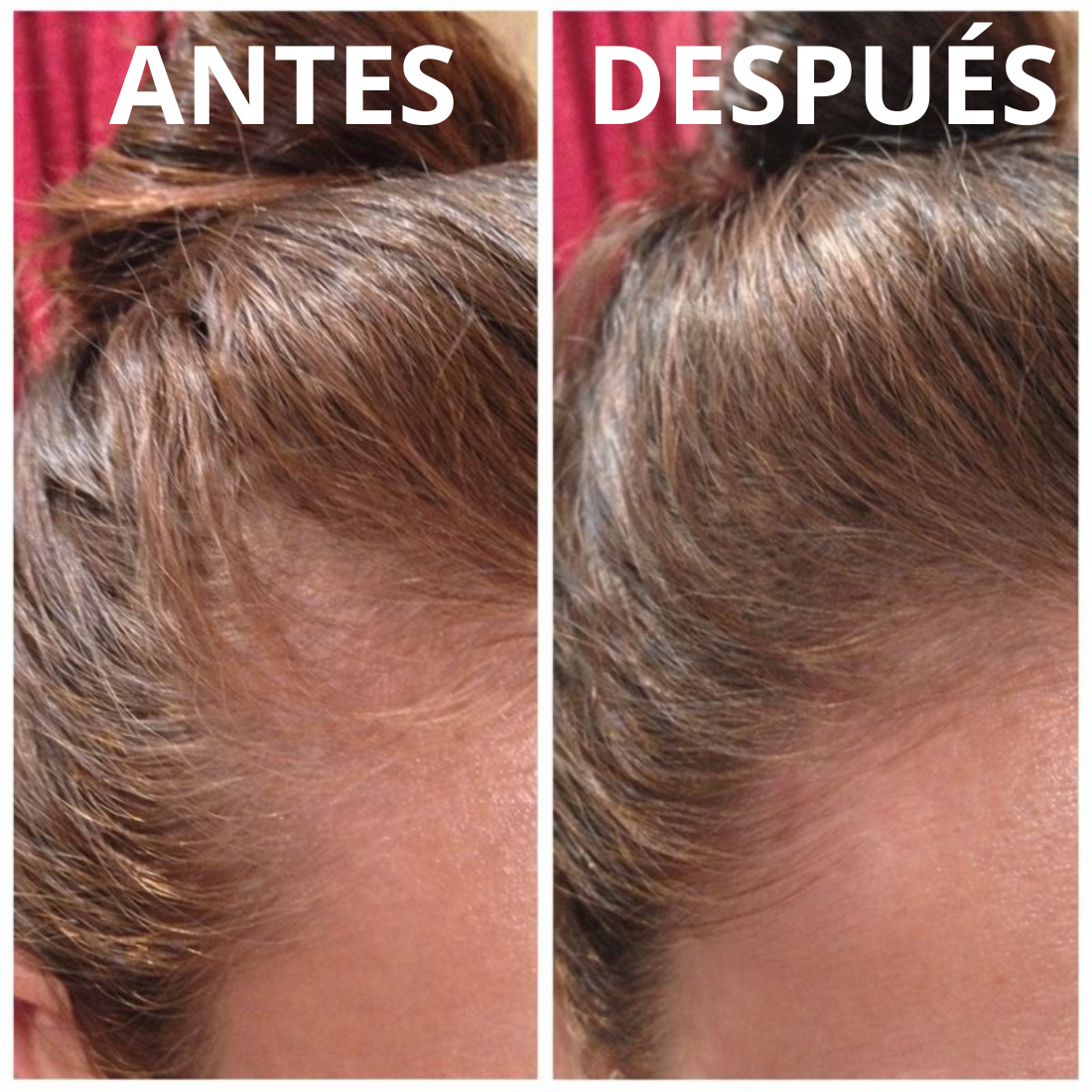HOEGOA Aceite de Batana  XXL 100ml — Crecimiento Capilar Natural y Reparación Profunda