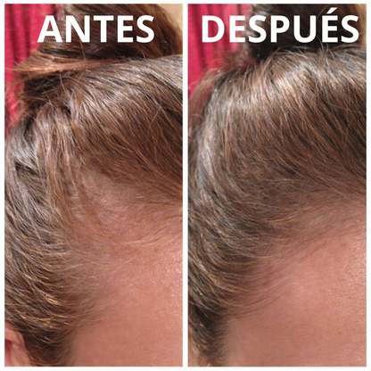 HOEGOA Aceite de Batana  XXL 100ml — Crecimiento Capilar Natural y Reparación Profunda