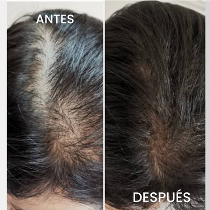 HOEGOA Aceite de Batana  XXL 100ml — Crecimiento Capilar Natural y Reparación Profunda