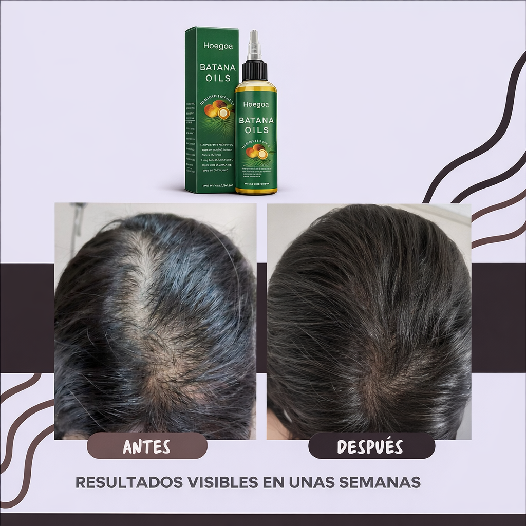 HOEGOA Aceite de Batana  XXL 100ml — Crecimiento Capilar Natural y Reparación Profunda