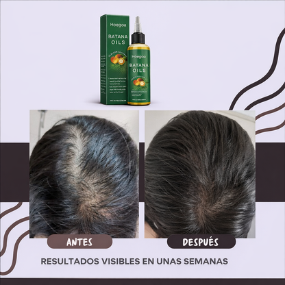 HOEGOA Aceite de Batana  XXL 100ml — Crecimiento Capilar Natural y Reparación Profunda