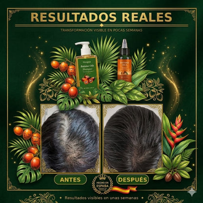 Aceite de Batana + Champú de Regalo 🎁 OFERTA EXCLUSIVA